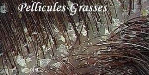 Pellicules grasses